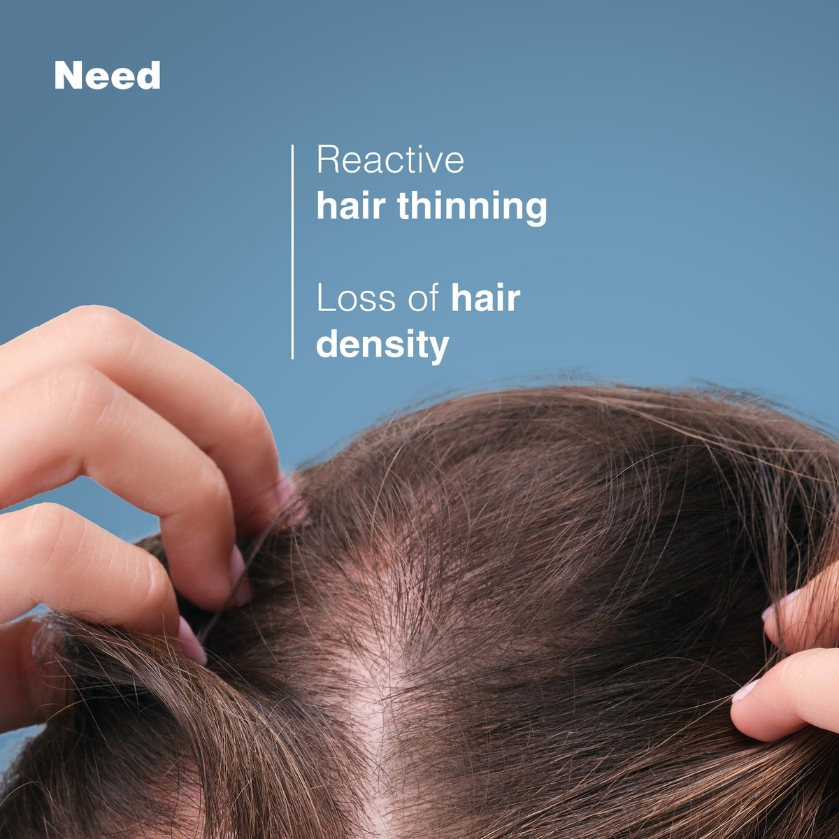 Anaphase Creastim - Strengthening shampoo - Reactional hair loss, Stressed hair - Pro-density - 400 ml Anaphase Creastim - Strengthening shampoo - Reactional hair loss, Stressed hair - Pro-density - 400 ml