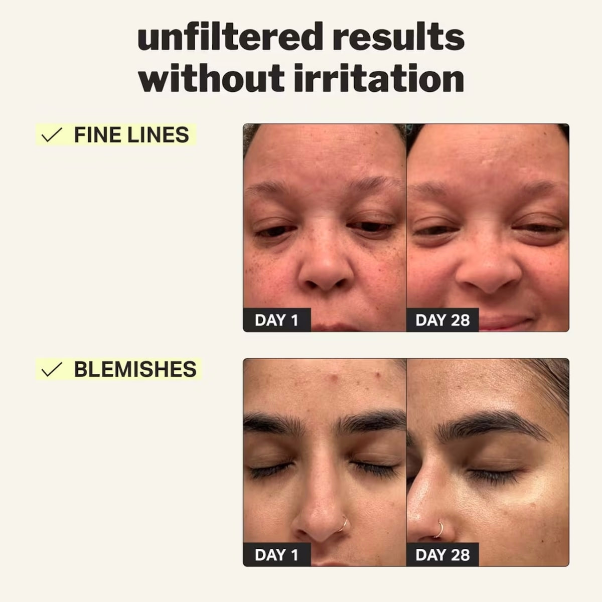 beginner retinol gel beginner retinol gel