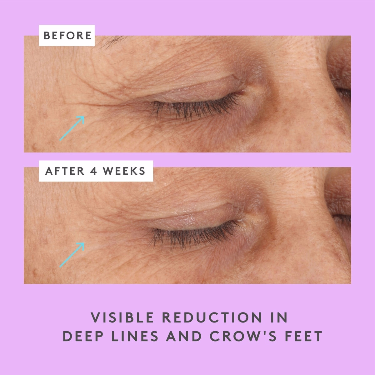 Ceramighty™ AF Eye Balm Ceramighty™ AF Eye Balm
