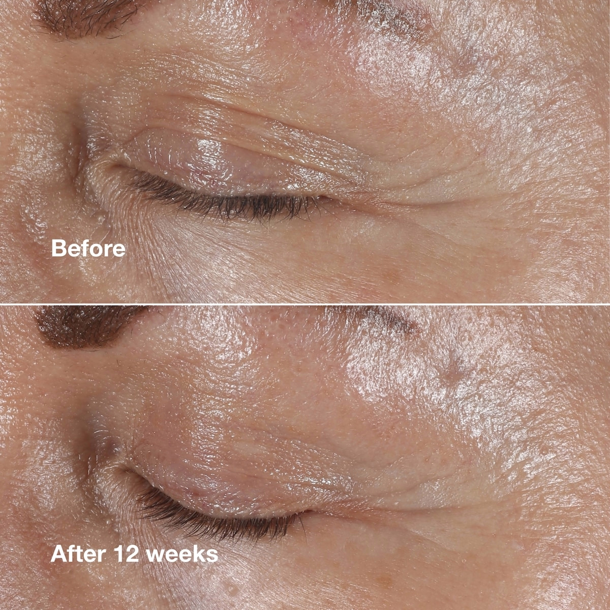 Clinique Smart Clinical Repair™ Wrinkle Correcting Eye Cream Clinique Smart Clinical Repair™ Wrinkle Correcting Eye Cream