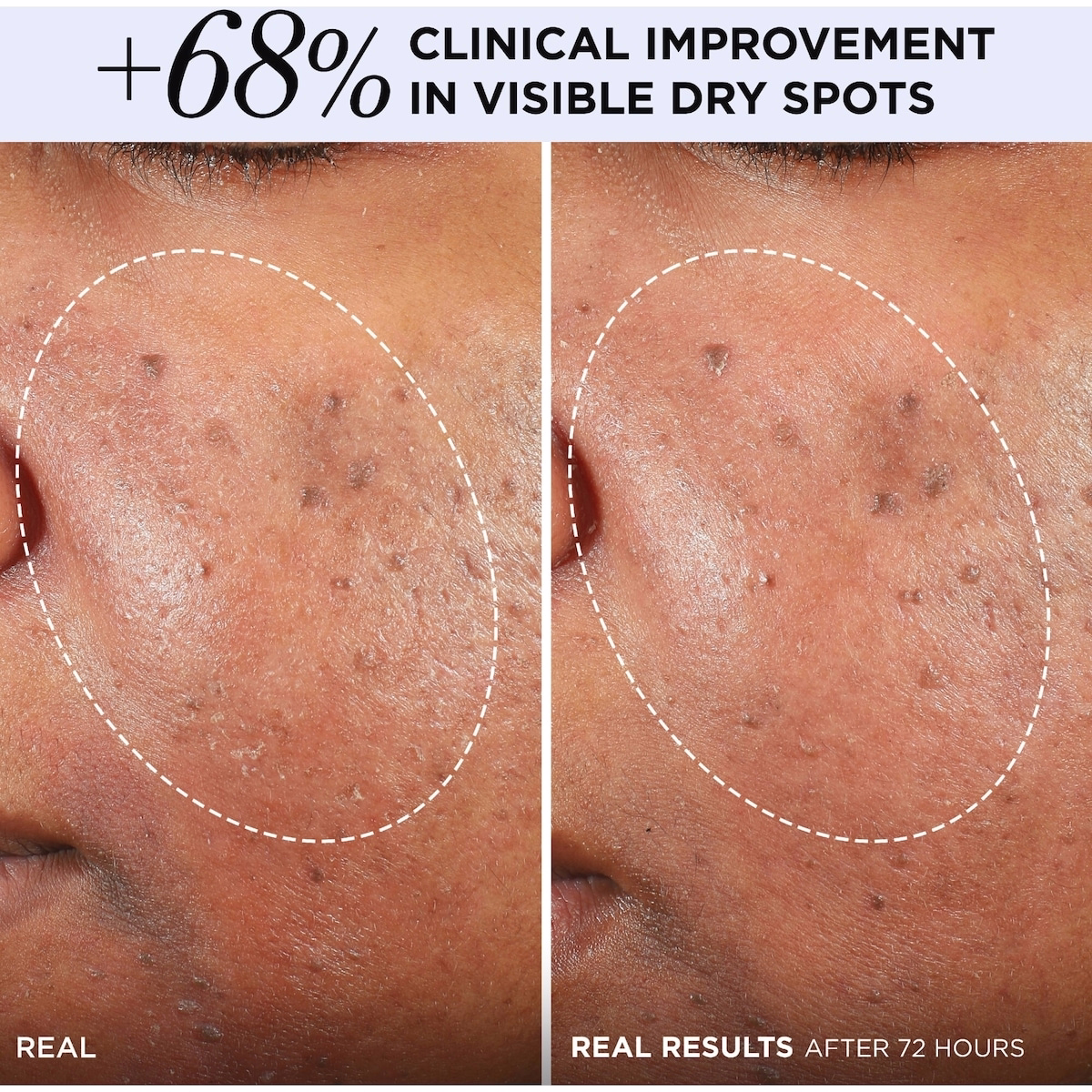 Confidence in a Cream Barrier Boost Moisturizer