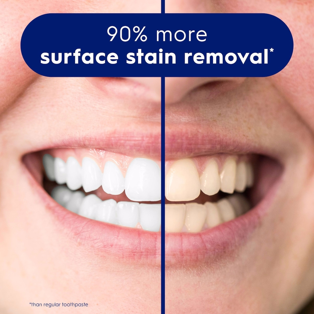 Crest 3D White Advanced, Teeth Whitening Toothpaste Radiant Mint, 135 ml Crest 3D White Advanced, Teeth Whitening Toothpaste Radiant Mint, 135 ml