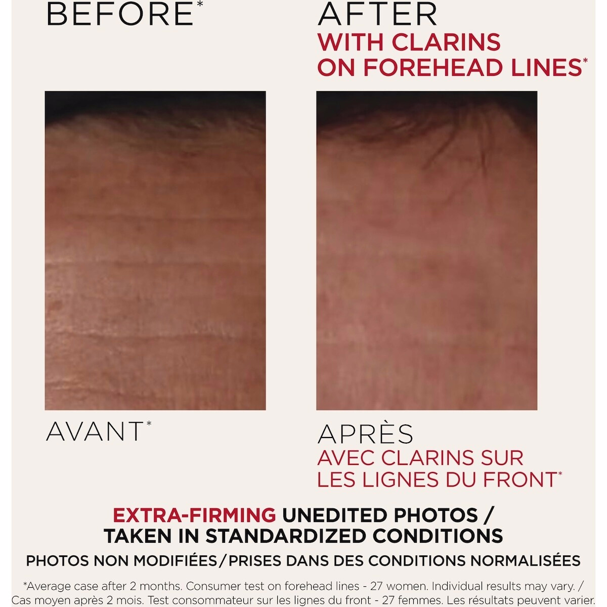 Extra-Firming Day - Dry Skin Extra-Firming Day - Dry Skin