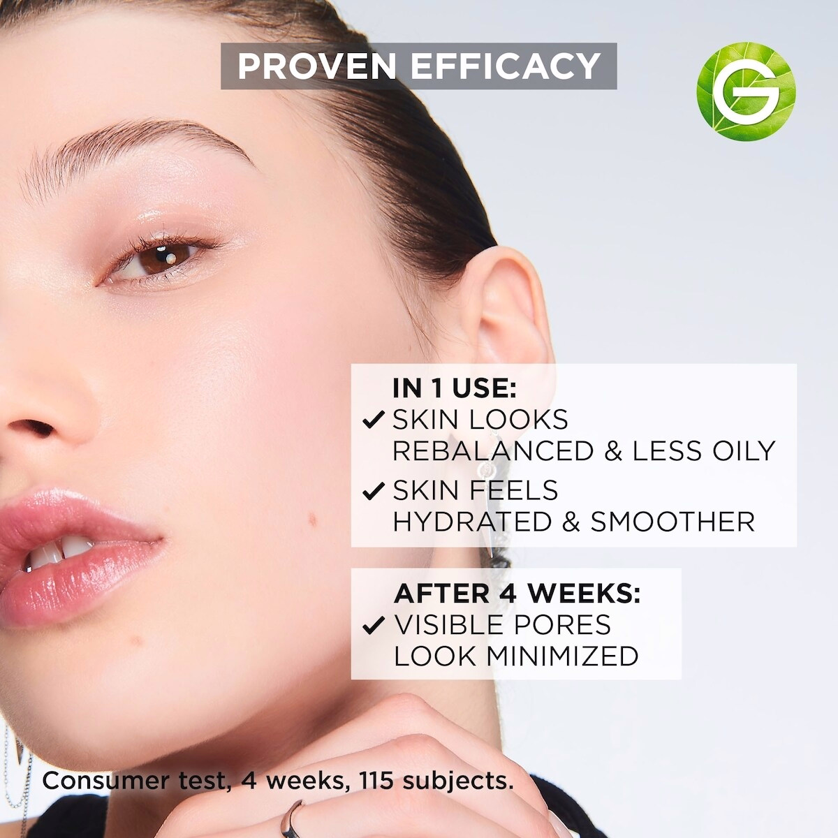 Face Moisturizer: Mattifying for Acne-Prone Skin