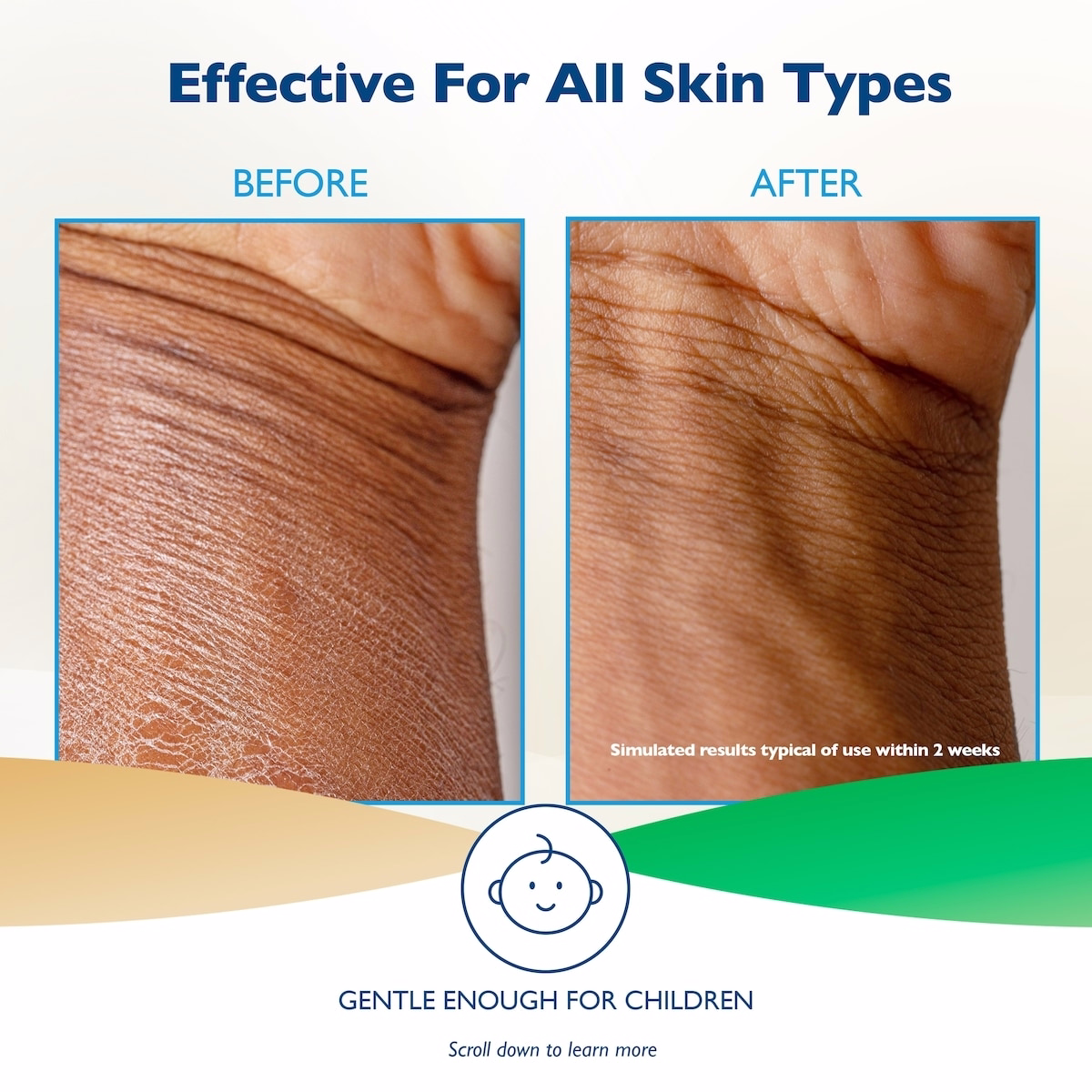 Glaxal Base 燕麥保濕霜 227 g Glaxal Base 燕麥保濕霜 227 g