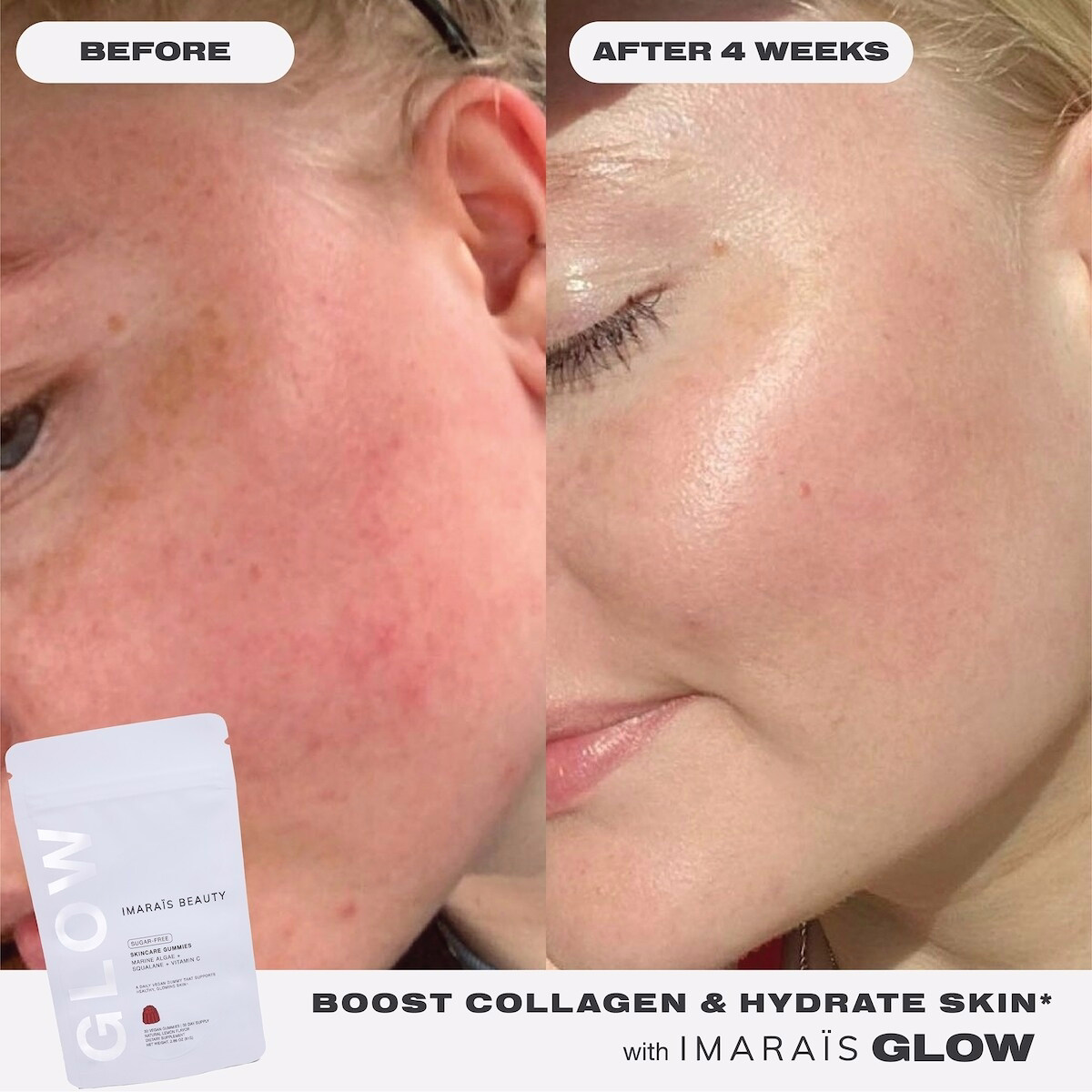 GLOW Skincare Gummies for Hydration, Collagen Boosting GLOW Skincare Gummies for Hydration, Collagen Boosting