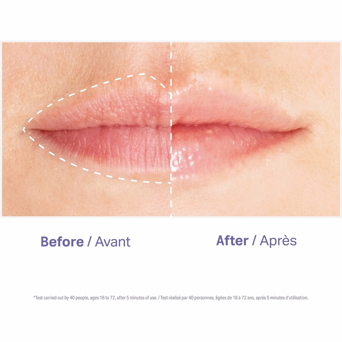 Glowfix Plump Glowfix Plump