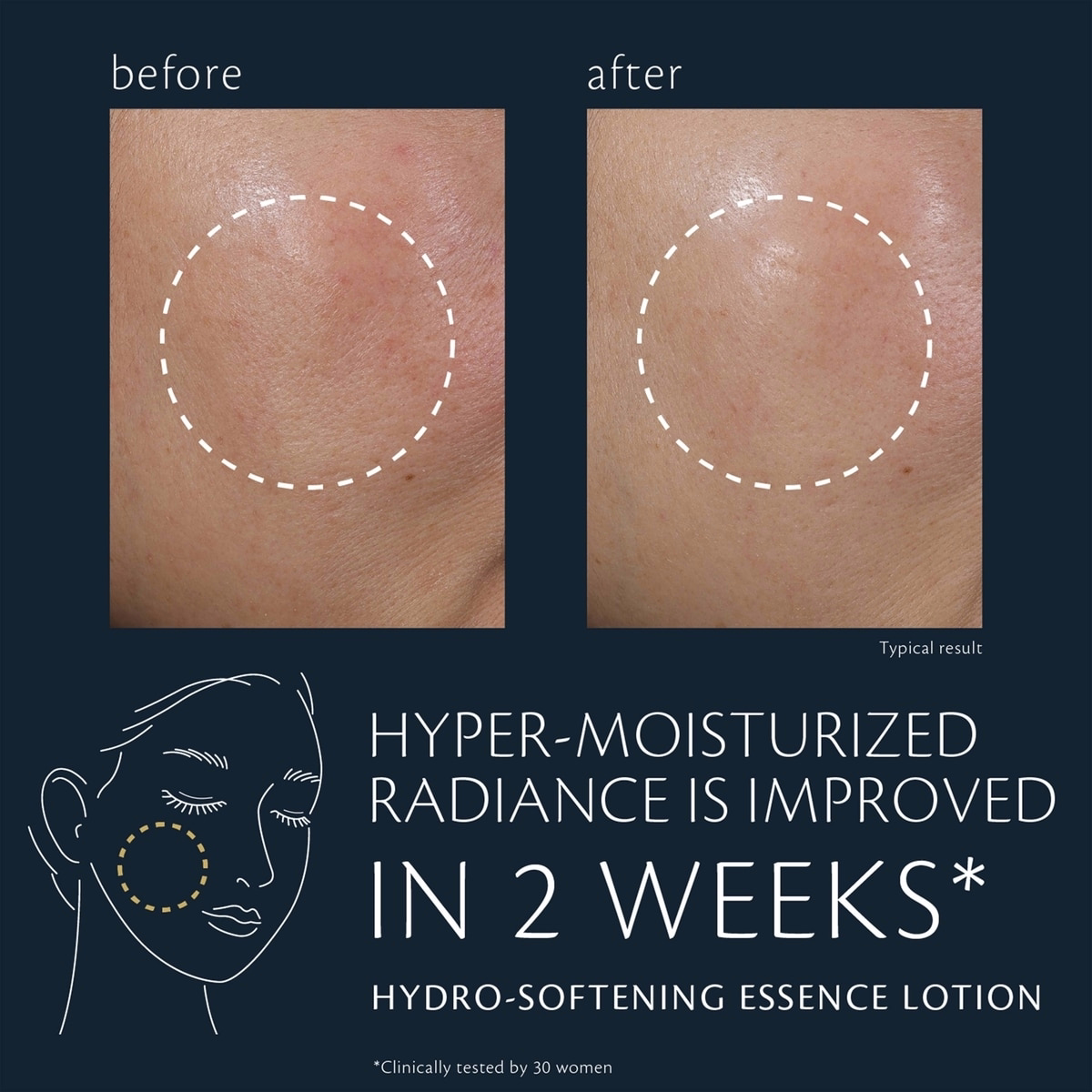 Hydro-softening Essence Lotion Hydro-softening Essence Lotion
