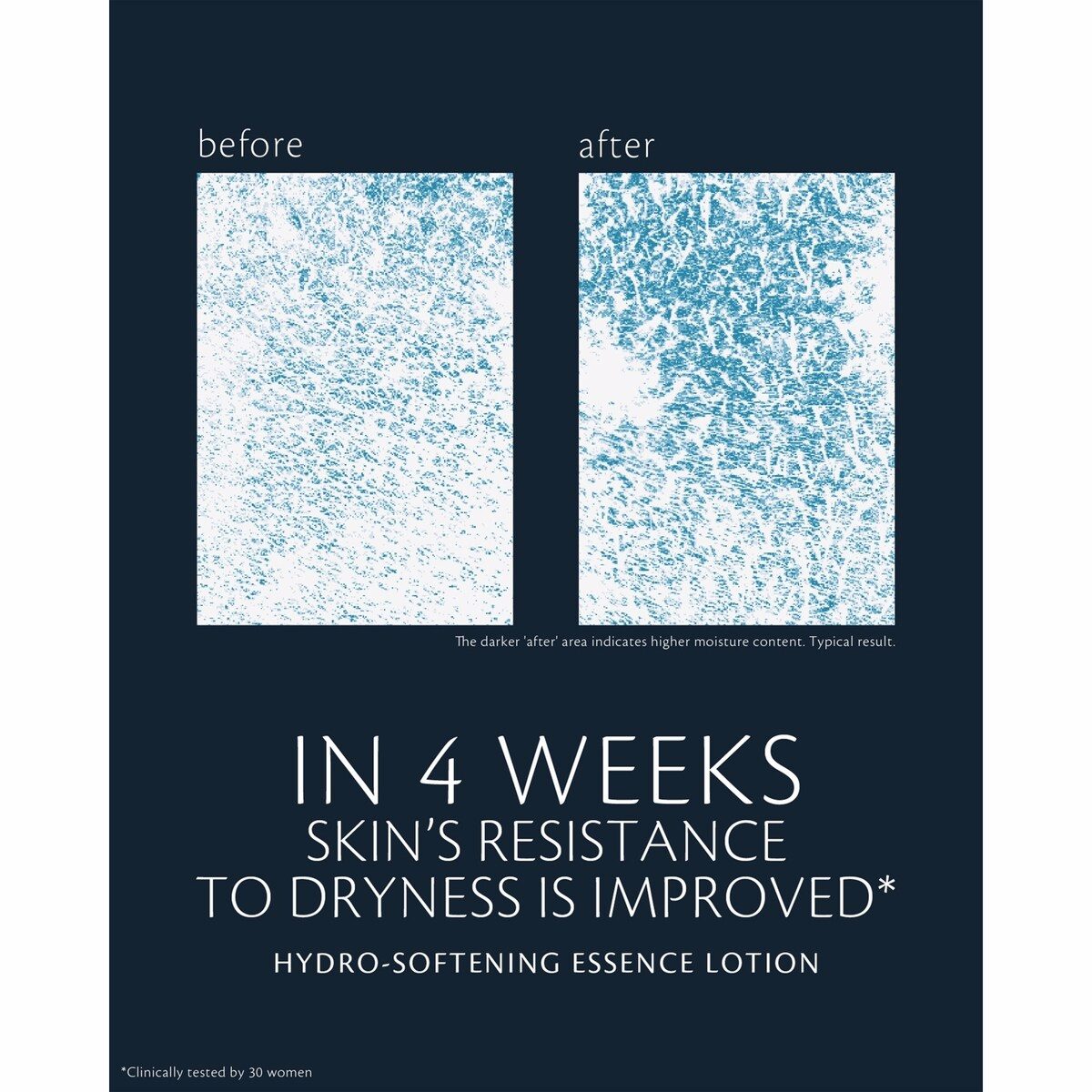 Hydro-softening Essence Lotion Hydro-softening Essence Lotion