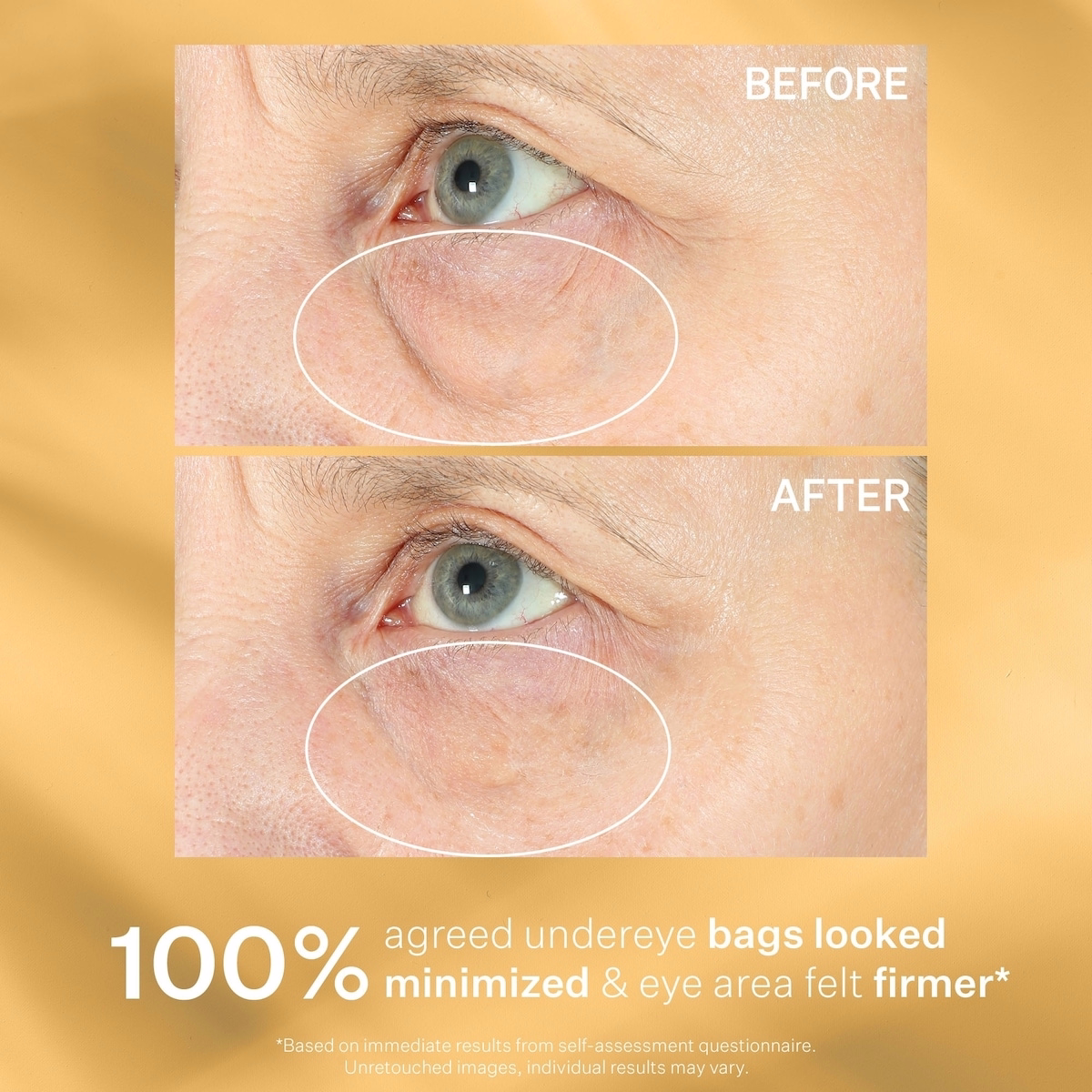 Hyperlift Eye™ 即效眼部修護