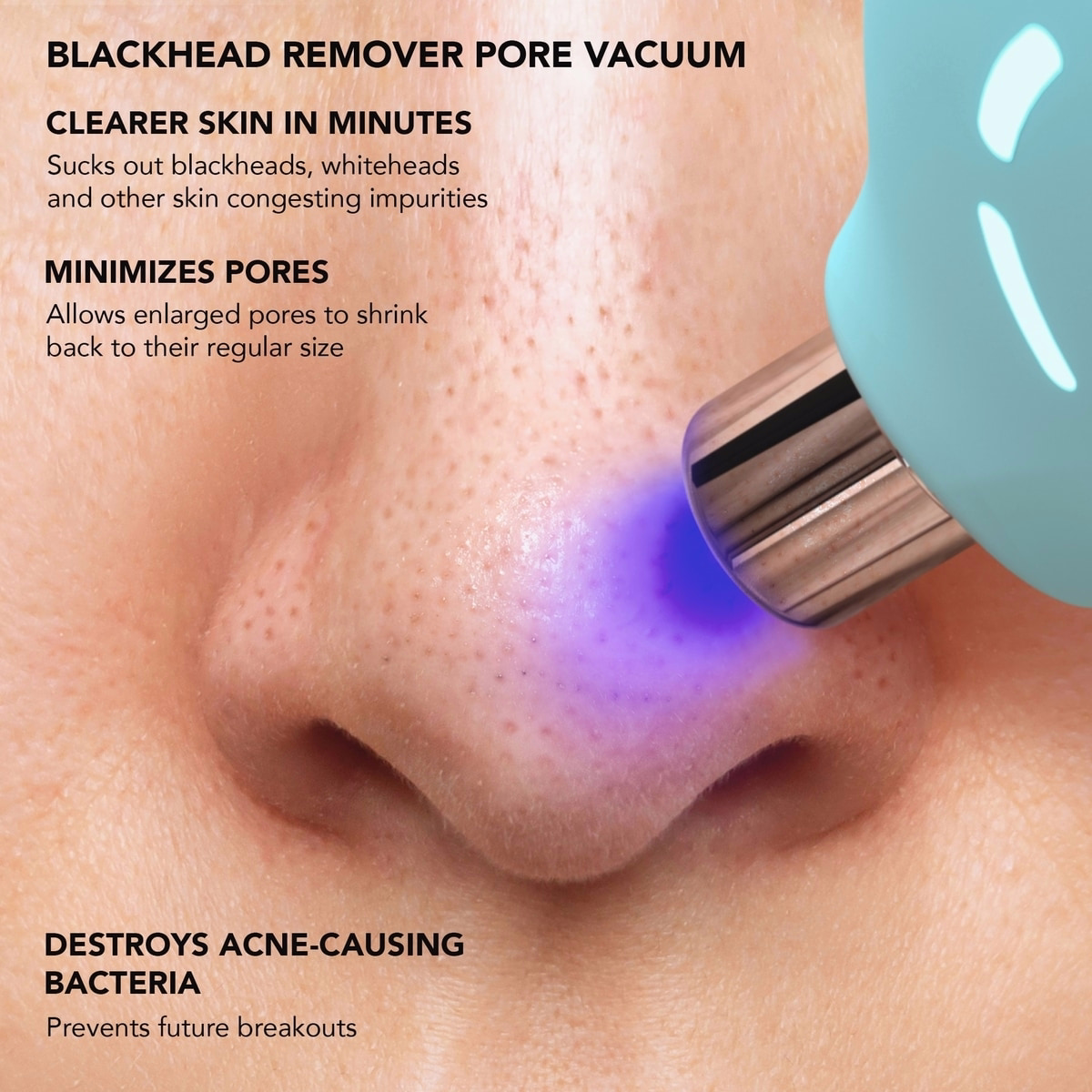 KIWI™ Blackhead Remover Pore Vacuum With Blue LED Light KIWI™ Blackhead Remover Pore Vacuum With Blue LED Light