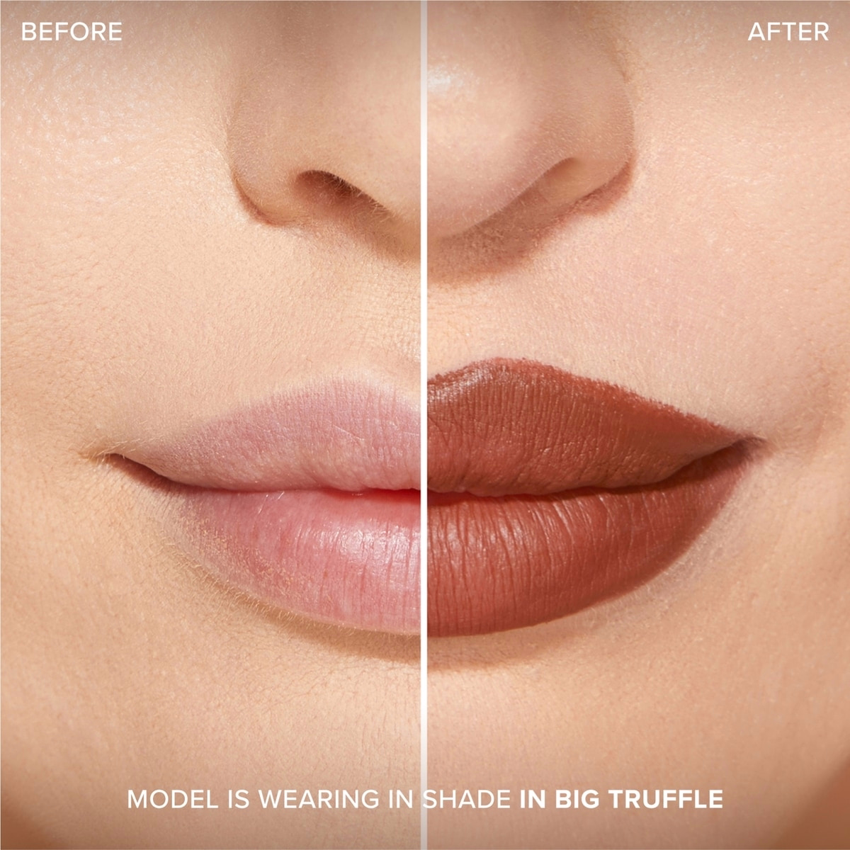 Lip Injection Extreme Lip Shaper Lip Injection Extreme Lip Shaper
