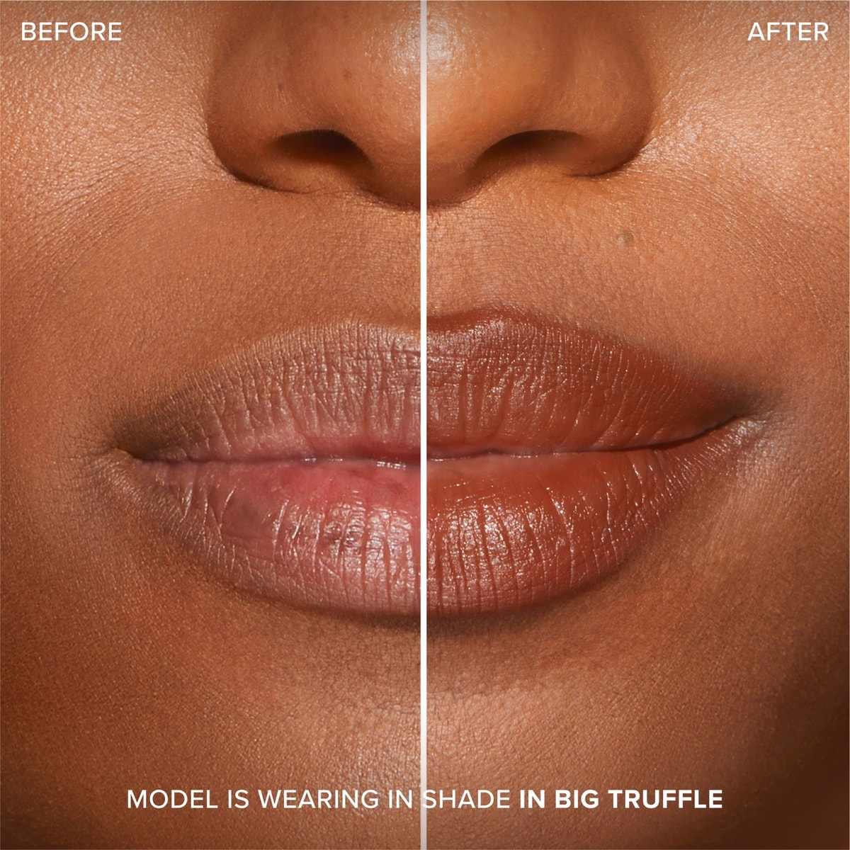 Lip Injection Extreme Lip Shaper Lip Injection Extreme Lip Shaper