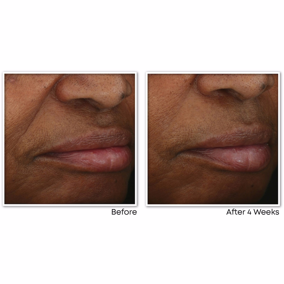 Multi Correxion Revive + Glow Gel Cream Multi Correxion Revive + Glow Gel Cream