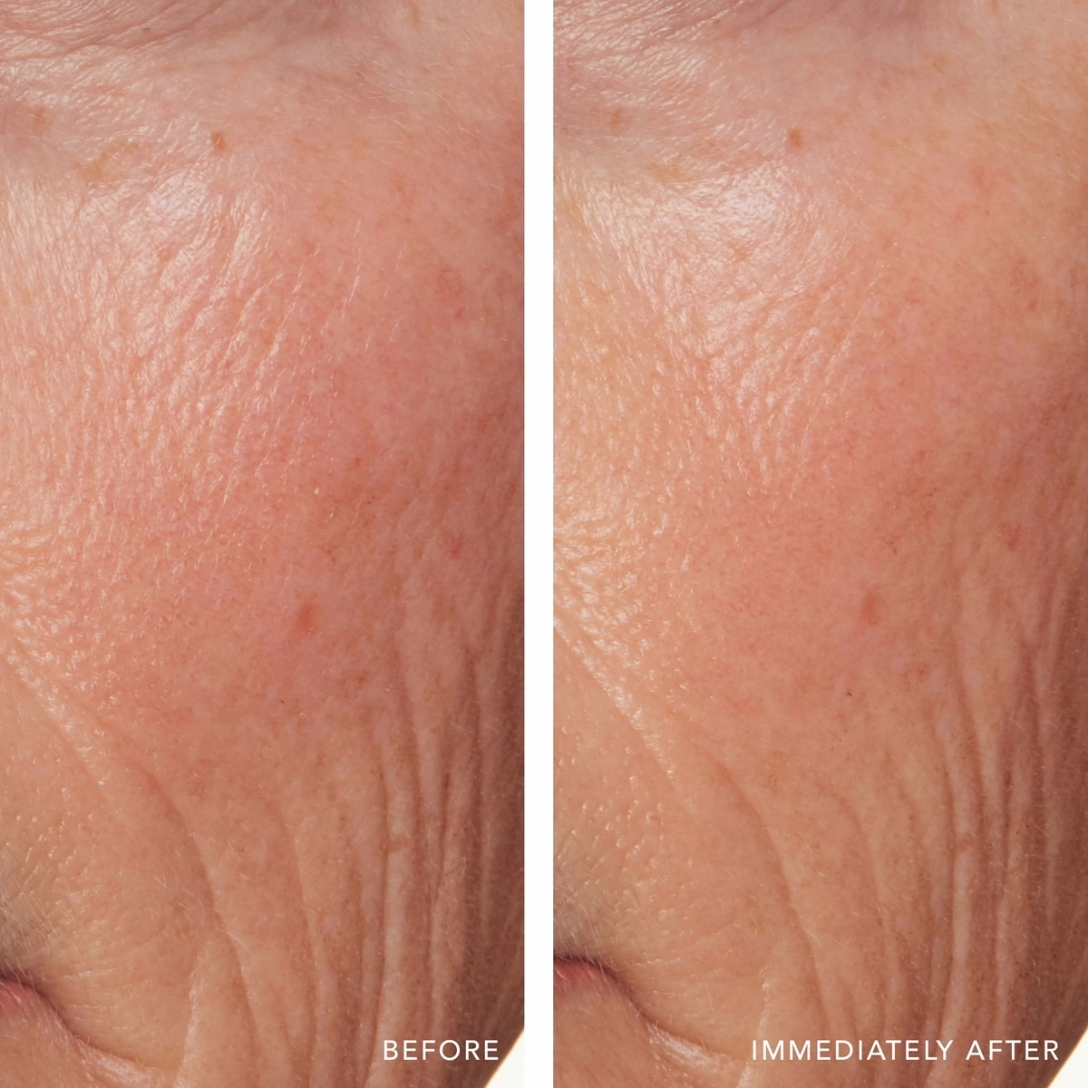 Redness Relief Intense with Manuka Honey Redness Relief Intense with Manuka Honey