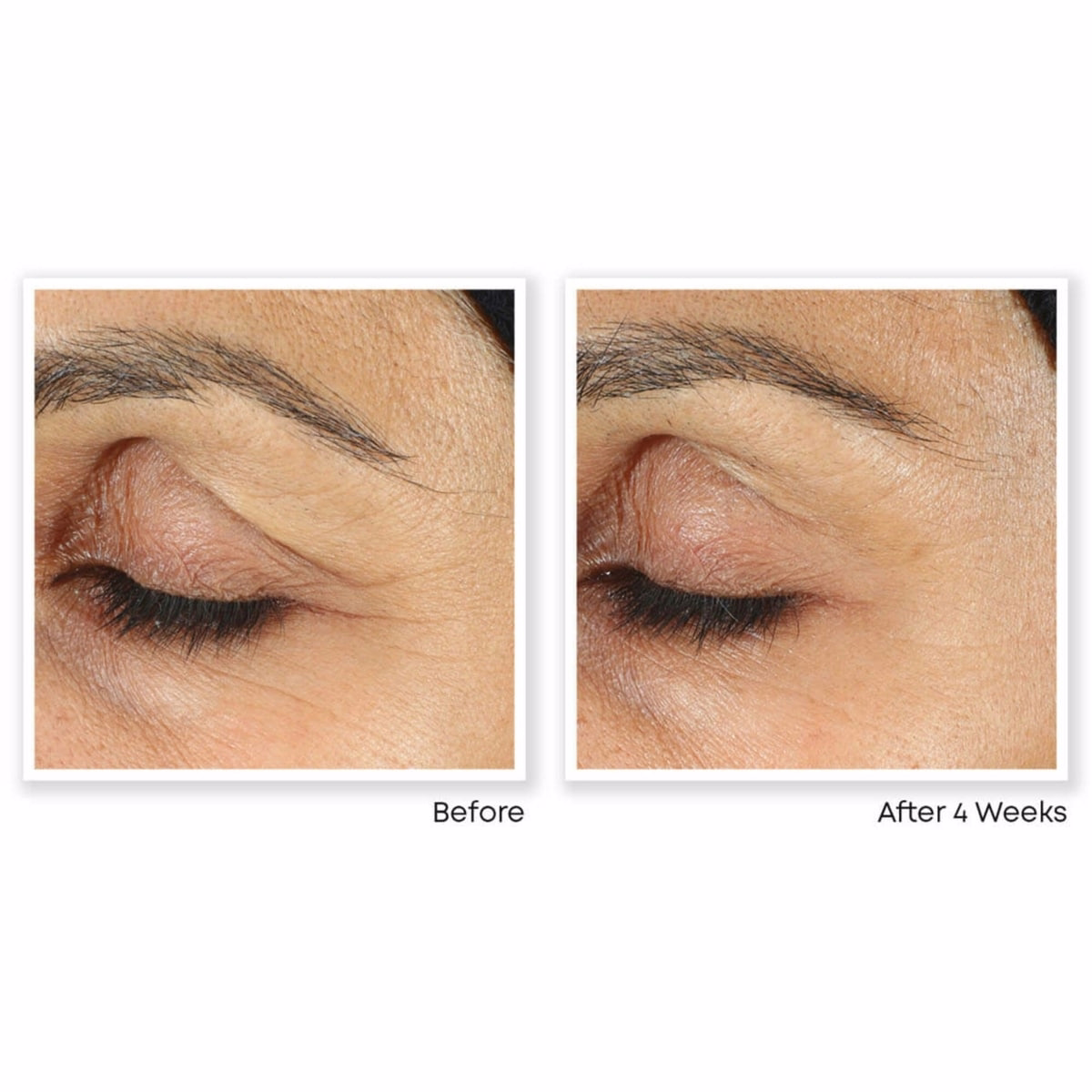 Retinol Correxion Line Smoothing Eye Cream