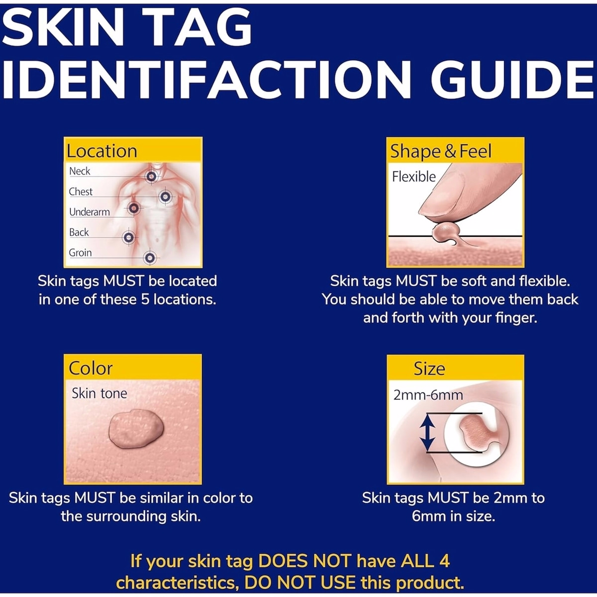 Skin Tag Remover Skin Tag Remover