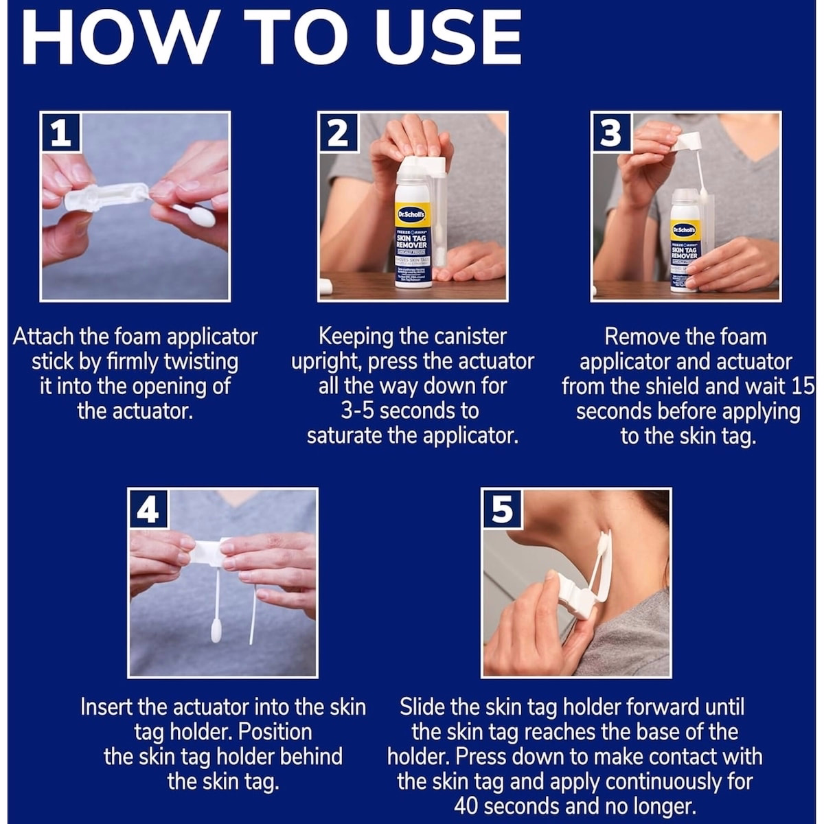 Skin Tag Remover Skin Tag Remover