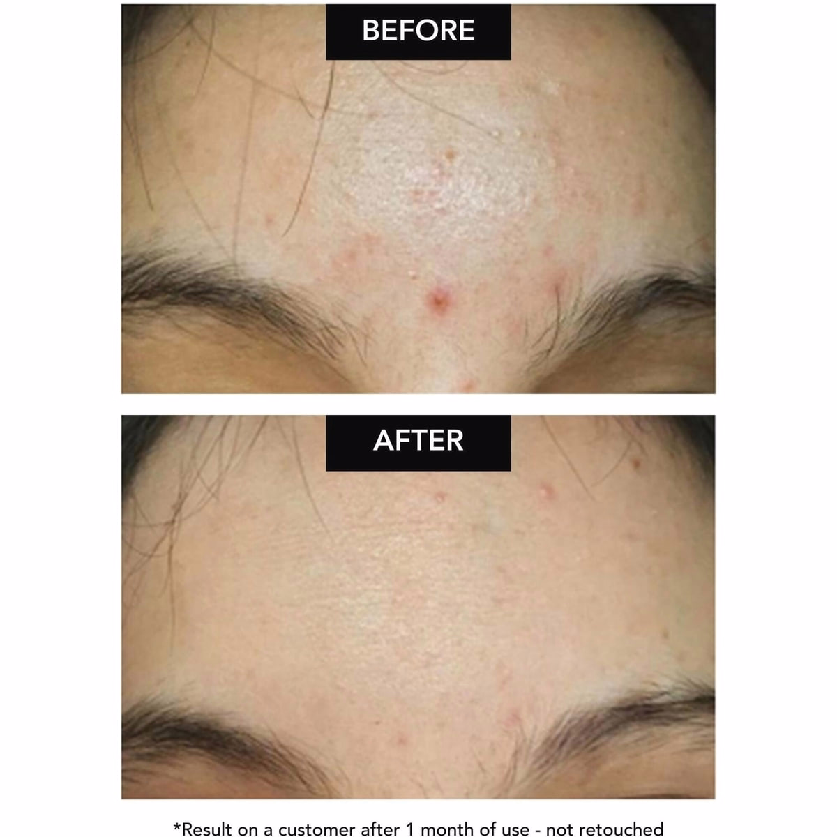 Tea Glow Exfoliating Lotion