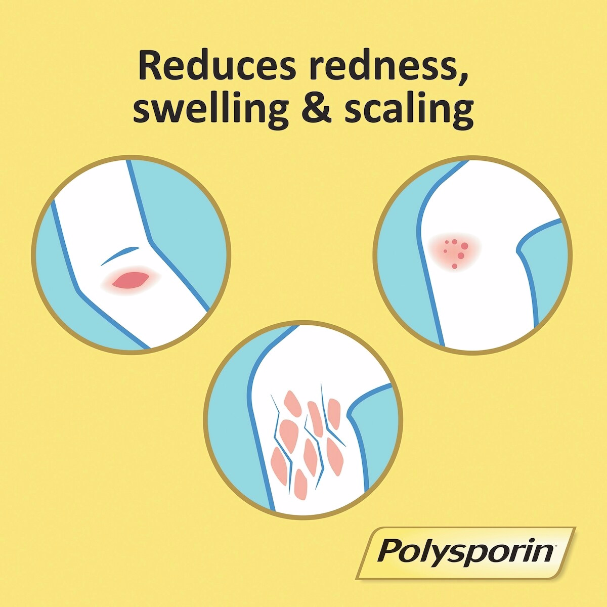 Crème antibiotiques triple, Formule Guérison Rapide Crème antibiotiques triple, Formule Guérison Rapide