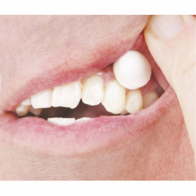 Xylimelts Xylimelts Adhering Pastilles Mild Mint Falvour 40.0 Pieces